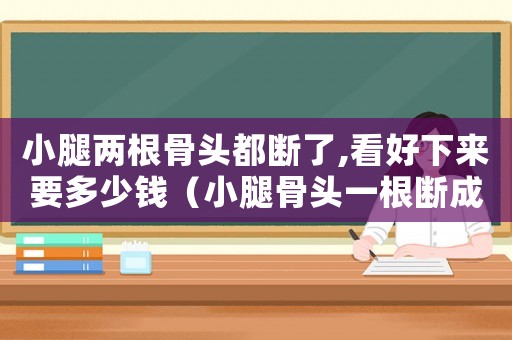 小腿兩根骨頭都斷了,看好下來要多少錢（小腿骨頭一根斷成兩根了工傷算幾級）