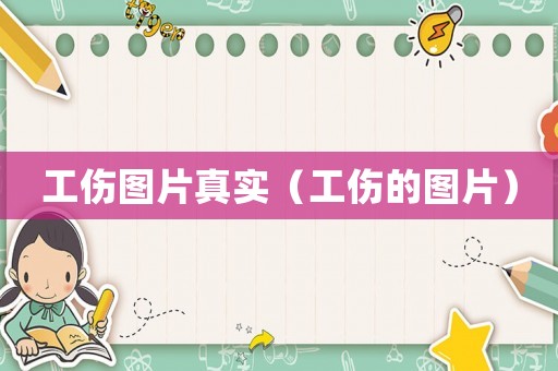 工傷圖片真實（工傷的圖片）